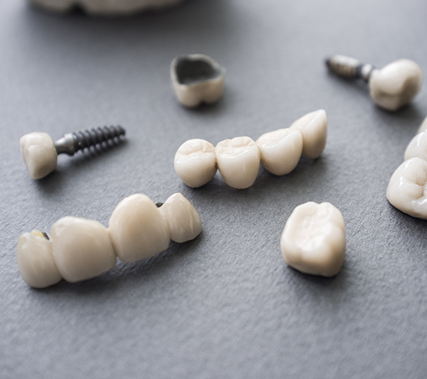 Coral Gables The Difference Between Dental Implants and Mini Dental Implants