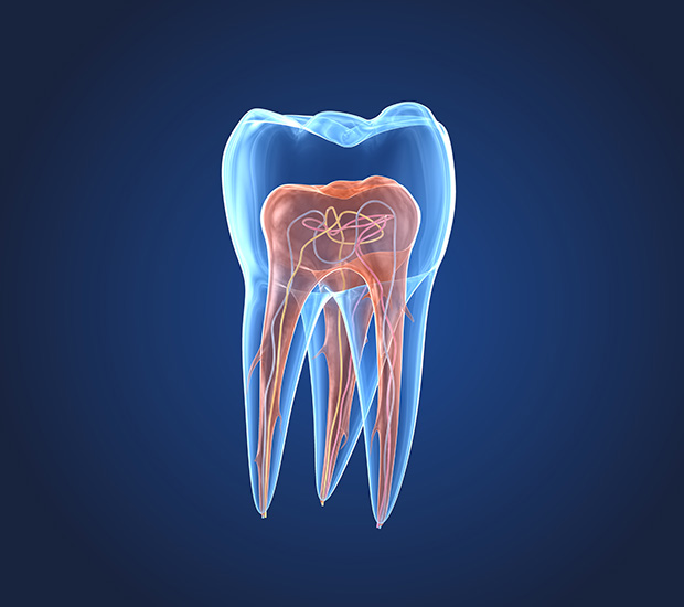 Coral Gables What is an Endodontist